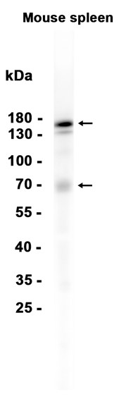 AYD14055