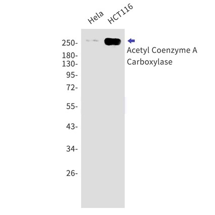 Acetyl Coenzyme A Carboxylase (YD20960) Rabbit mAb