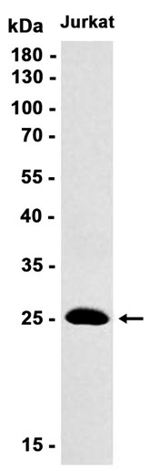 AYD11520
