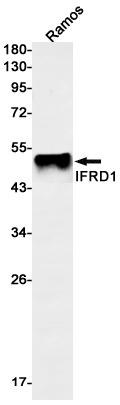 AYD14115