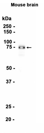 Synapsin I (YD35509) Rabbit mAb