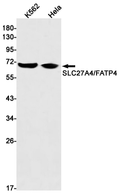 AYD13645