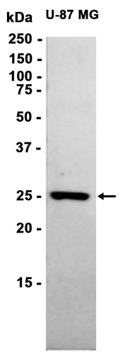 AYD15684
