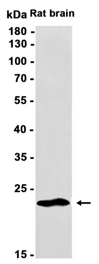 AYD14159