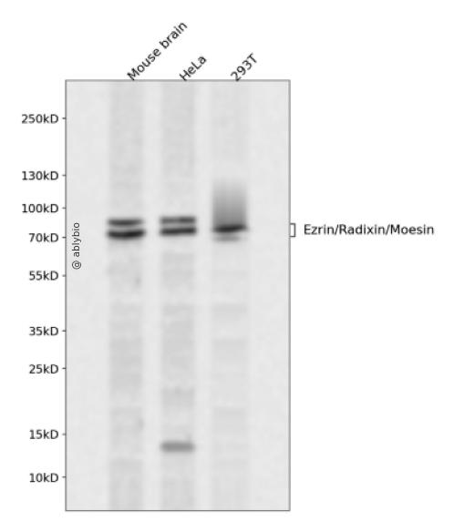 Ezrin/Radixin/Moesin (Phospho Thr567/Thr564/Thr558) Rabbit mAb