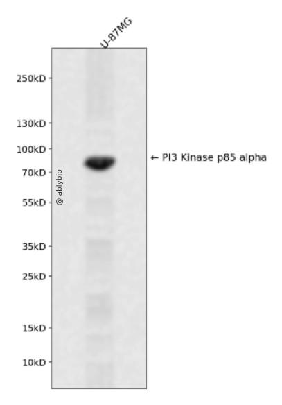 PI3-Kinase p85 &alpha; Rabbit mAb