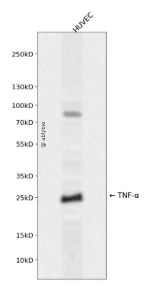 TNF alpha (YD15423) Rabbit mAb