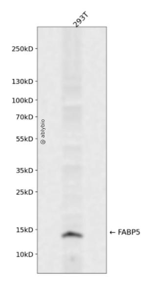 FABP5 Rabbit mAb