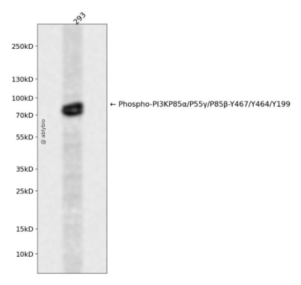PI3 Kinase p85 (Phospho Tyr458)/p55 (Phospho Tyr199) Rabbit mAb