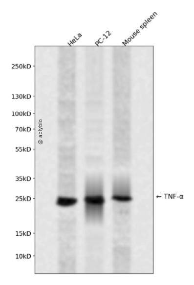 TNF &alpha; Rabbit mAb