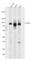 IL-1R alpha /CD121 alpha Rabbit mAb