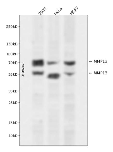 MMP13 Rabbit mAb