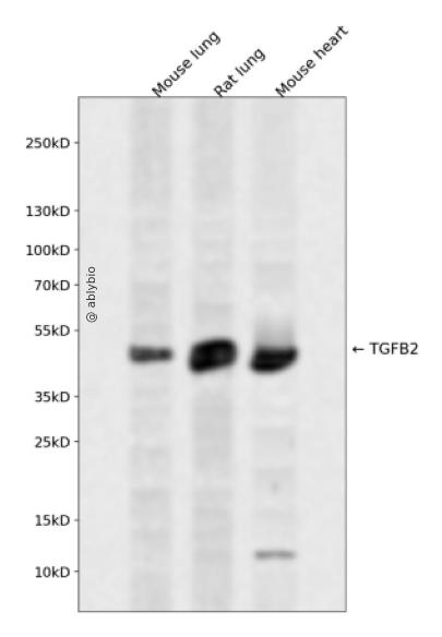 TGF beta 2 Antibody