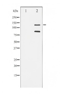CD68 (YD34708) Mouse mAb