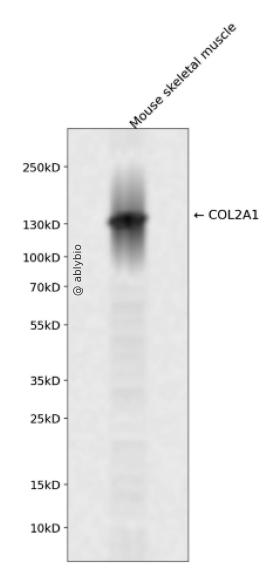 Collagen II Rabbit mAb