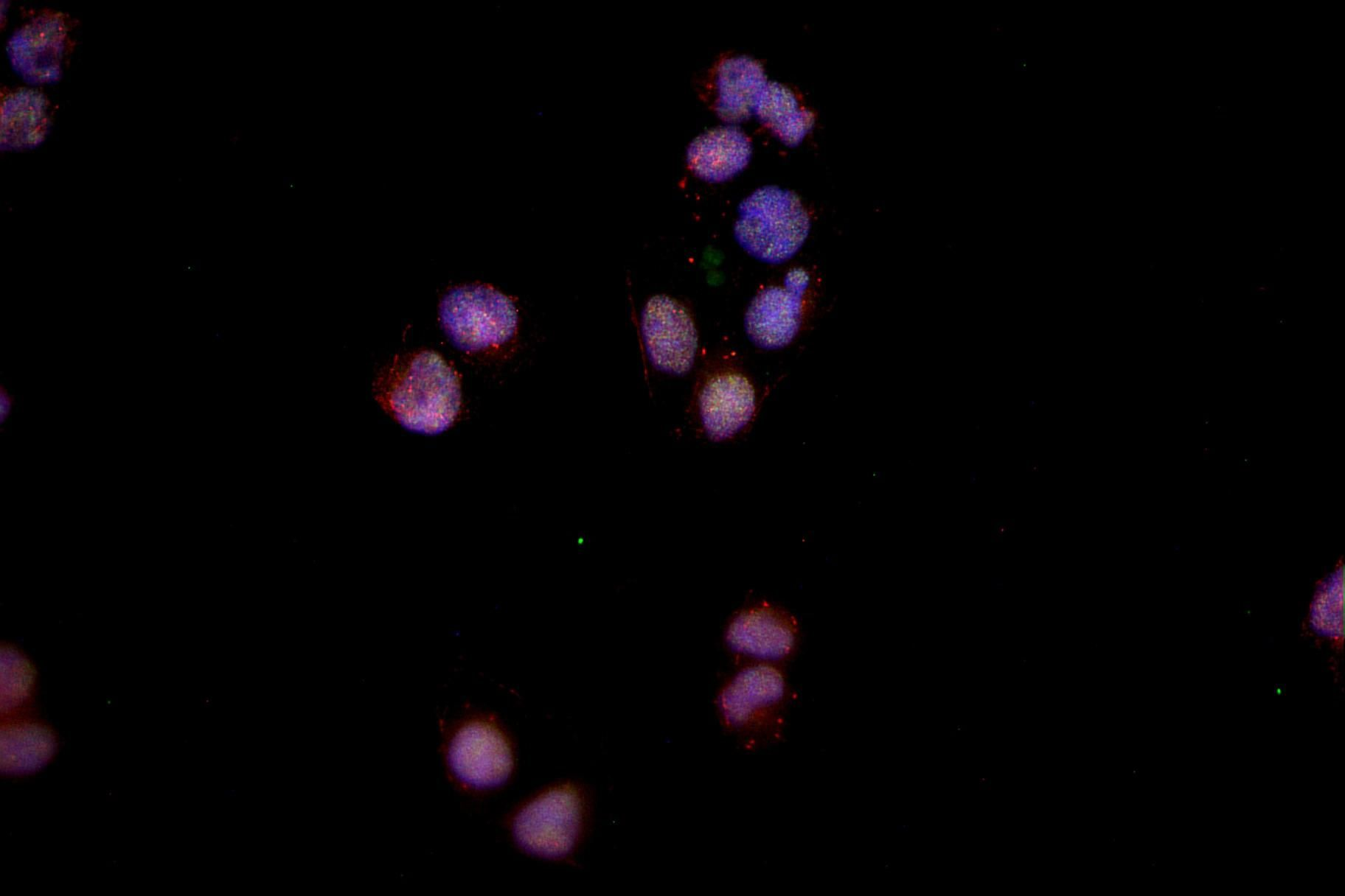 LAP2 alpha Antibody