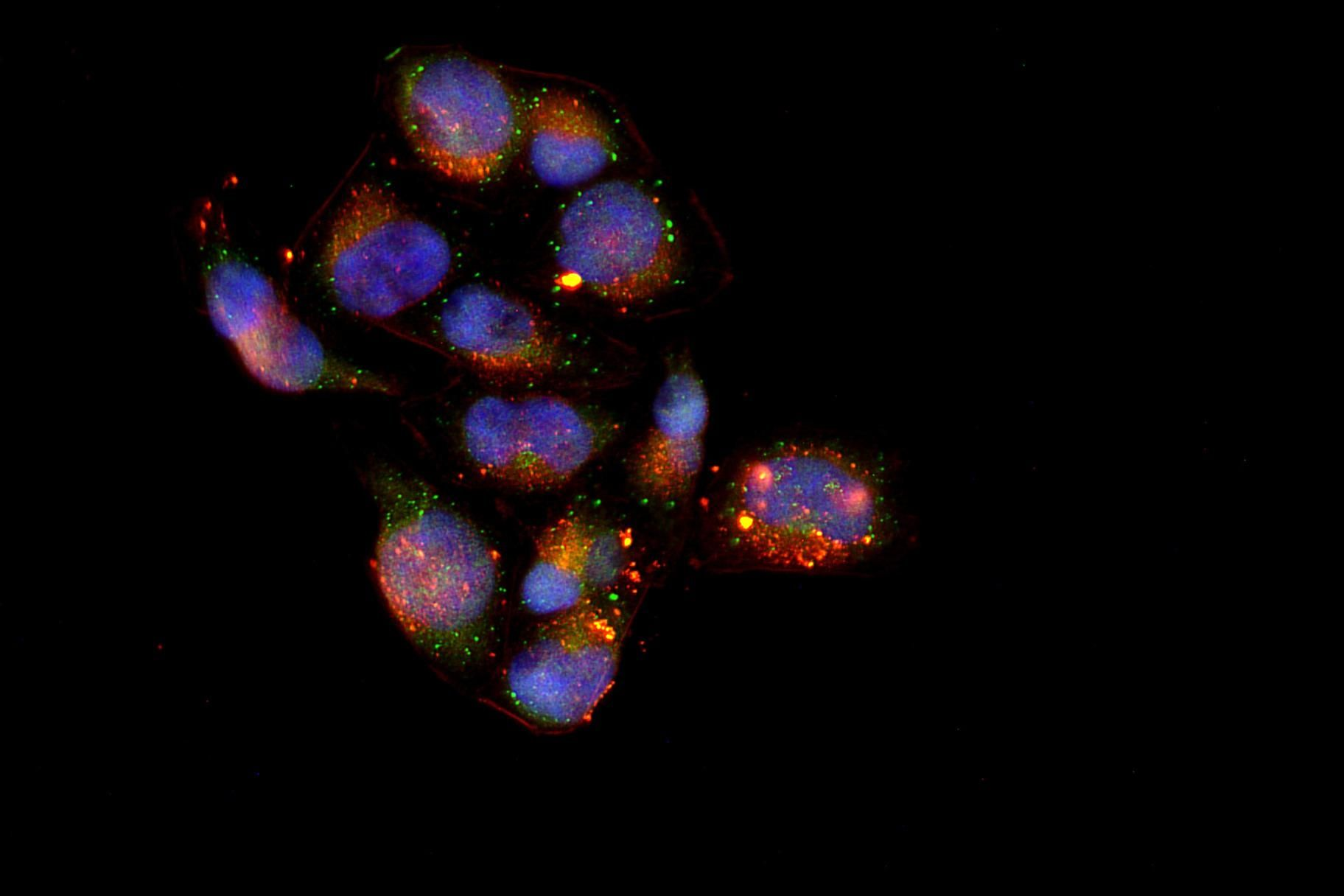 Retinoblastoma Rabbit pAb