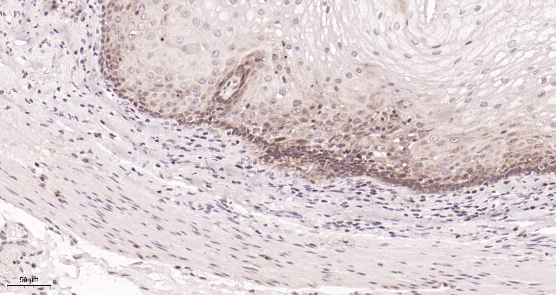 Histone H3 (Citrulline Arg2+Arg8+Arg17) Rabbit mAb