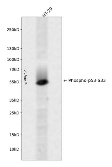 Phospho-p53 (Ser33) (YD36203) Rabbit mAb