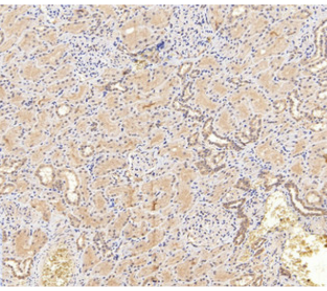 Cleaved-Caspase 1 (Asp296), p20  Rabbit pAb