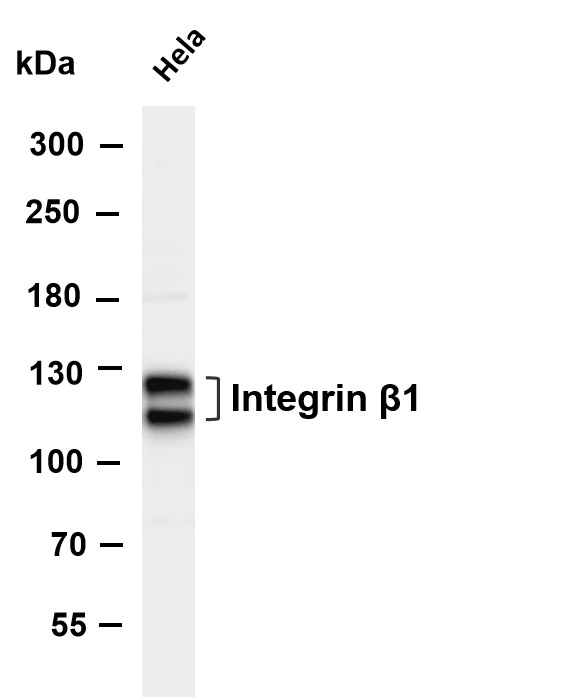 ITGB1 (Phospho-Tyr795) Antibody
