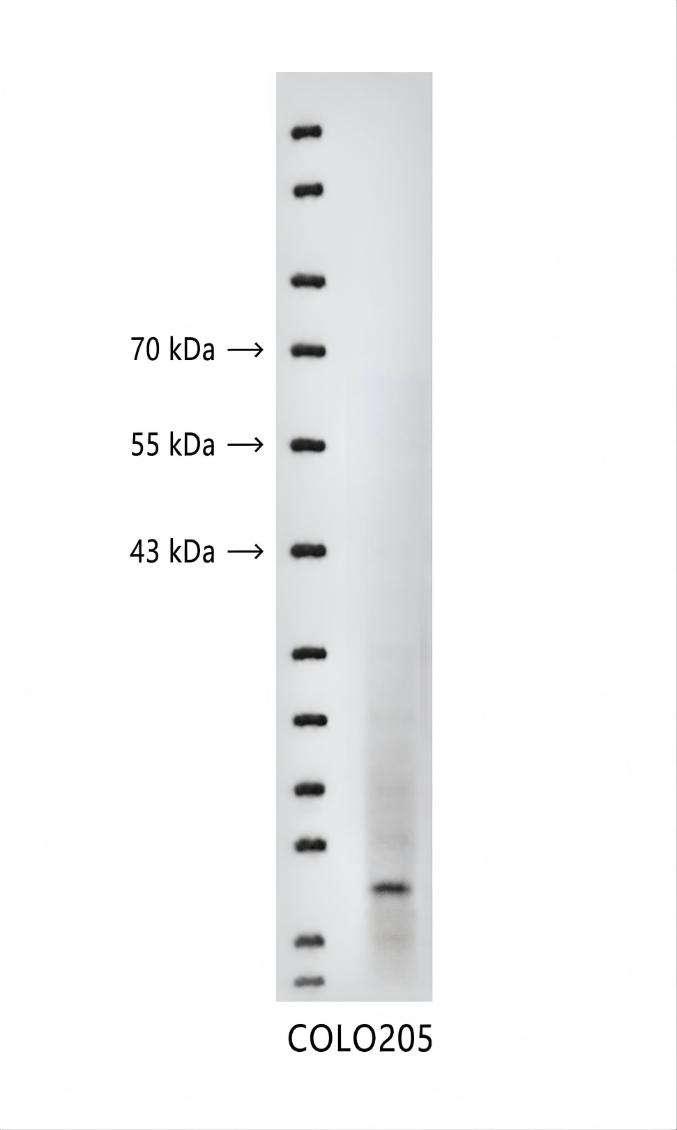 S100 Calcium Binding Protein A13 (YD13119) Rabbit mAb