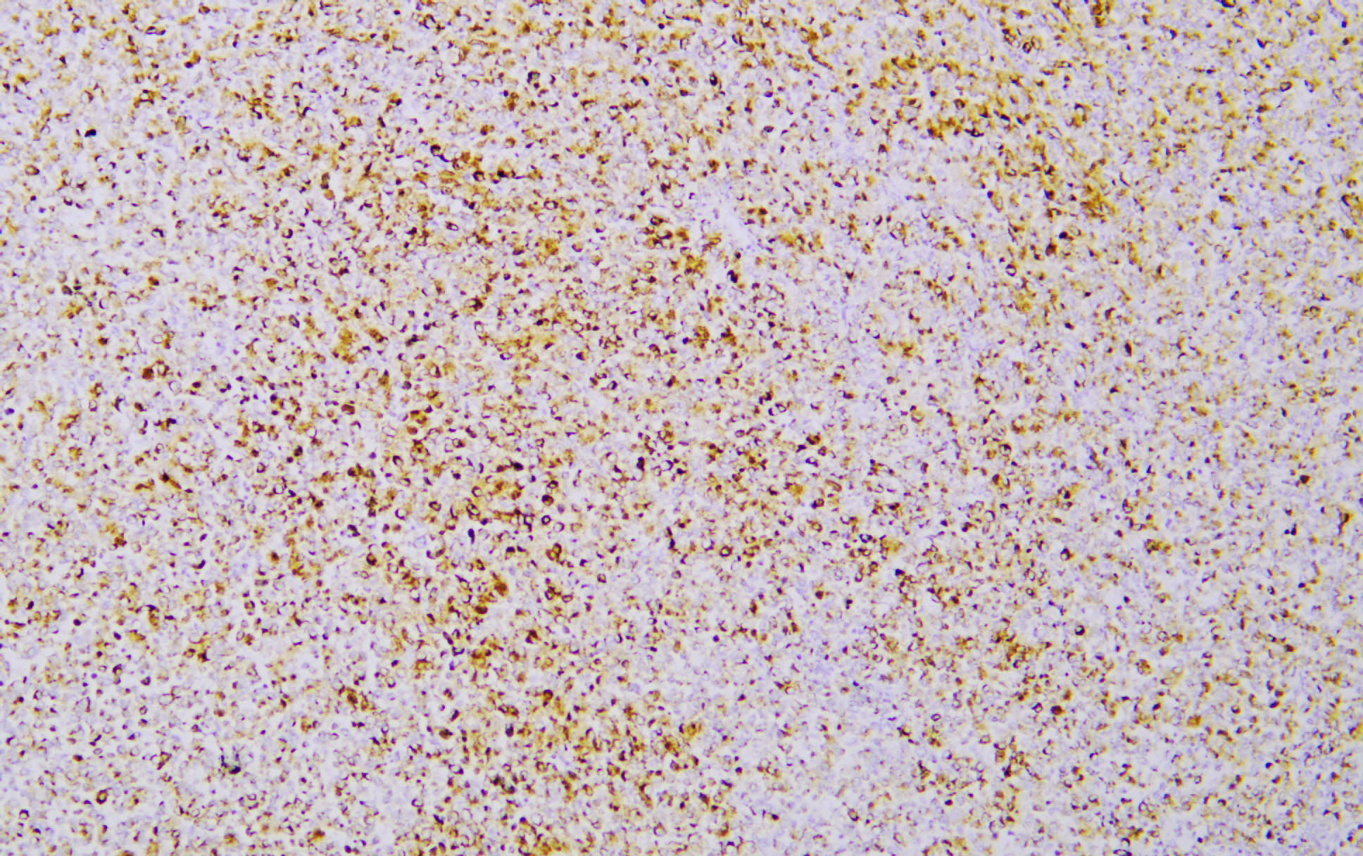 CD63 (YD19296) Rabbit mAb