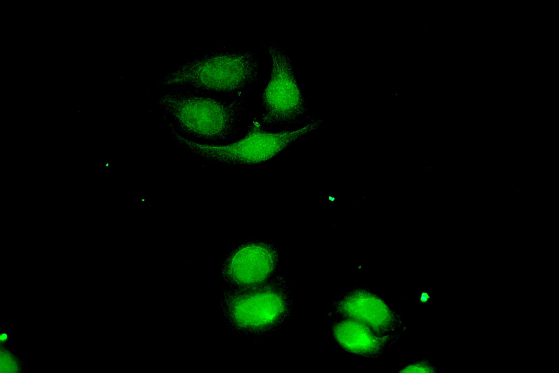 Phospho-beta Catenin (Ser675) pAb