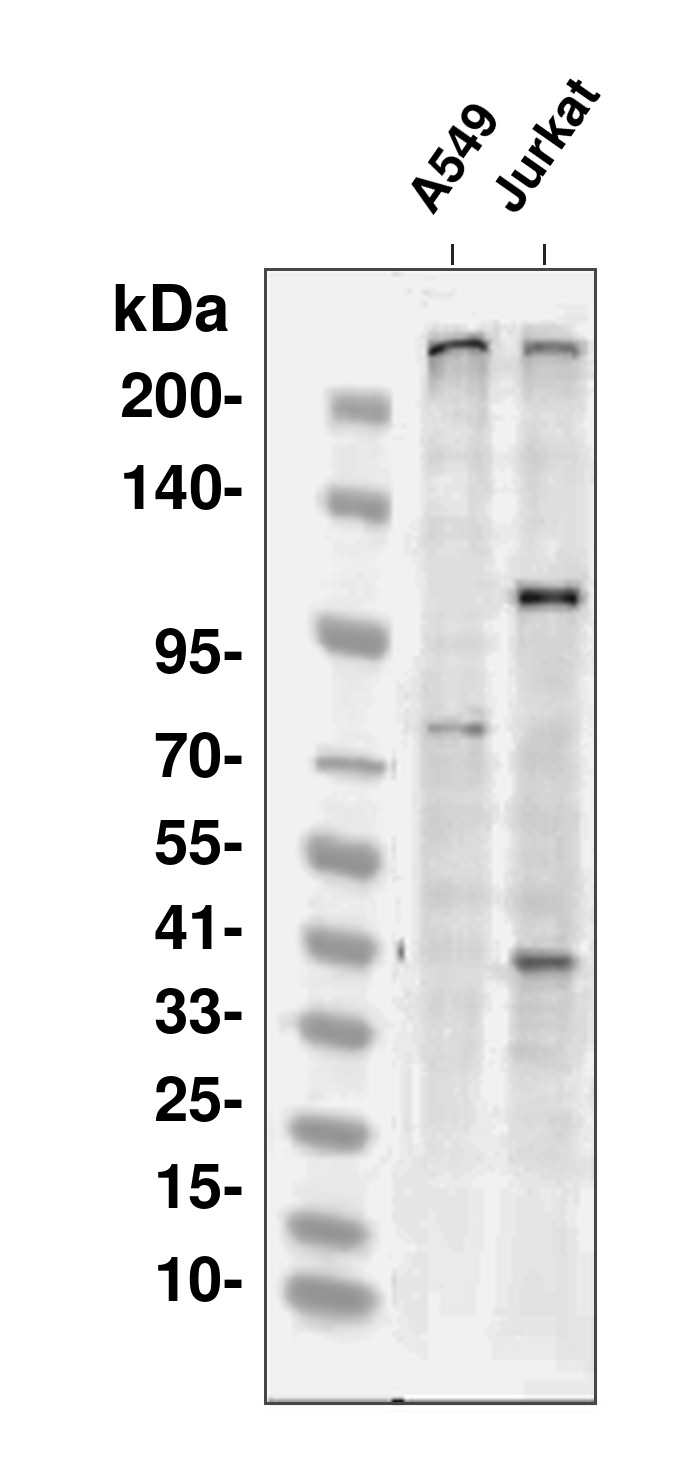 p300  Rabbit mAb