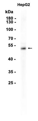 Phospho-p53 (Ser15) (YD16438) Rabbit mAb