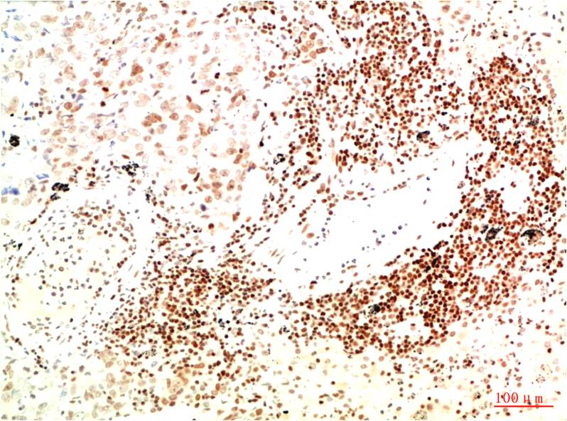 Phospho-JAK2 (Tyr570) pAb