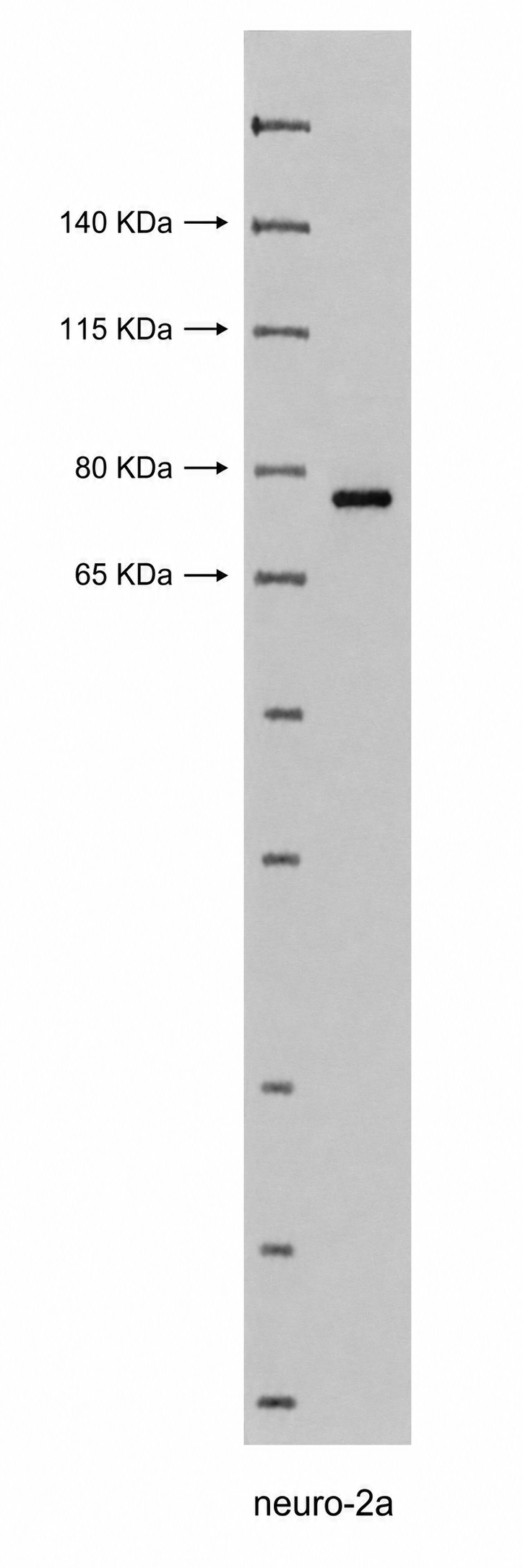 GRP78/BiP Rabbit mAb