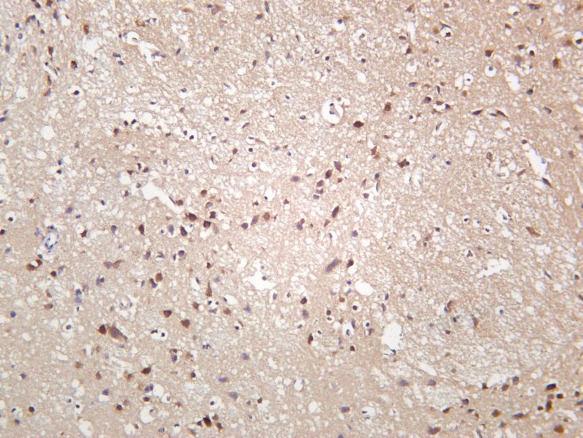 p70 S6 kinase &beta; (Phospho Ser371)  Rabbit mAb