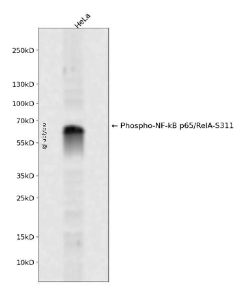 NF-&kappa;B p65 (Phospho-Ser311) Antibody