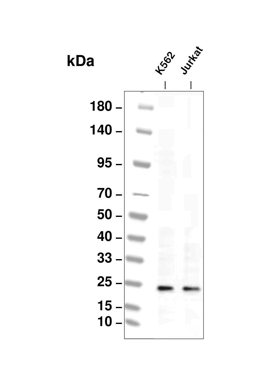 Rab11A (YD18374) Rabbit mAb
