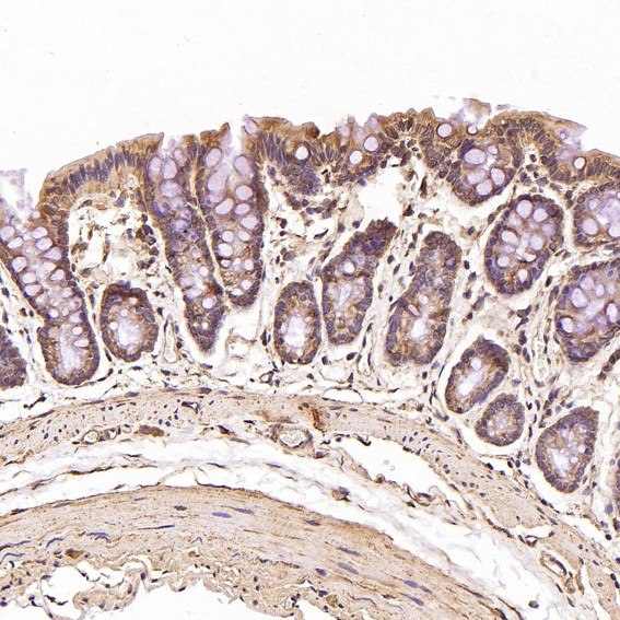 JNK2 Rabbit mAb