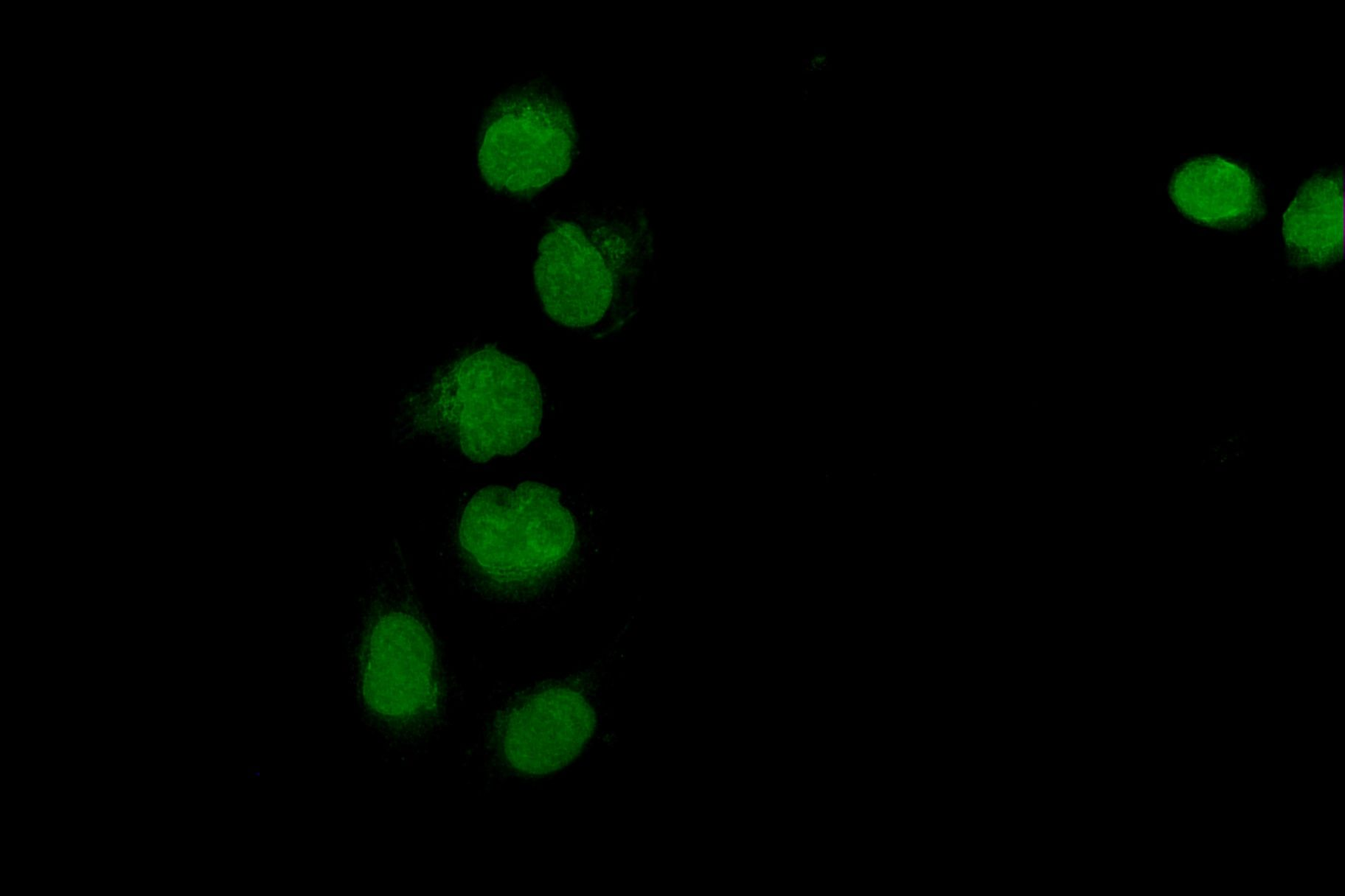 Phospho-beta Catenin (Ser552) pAb