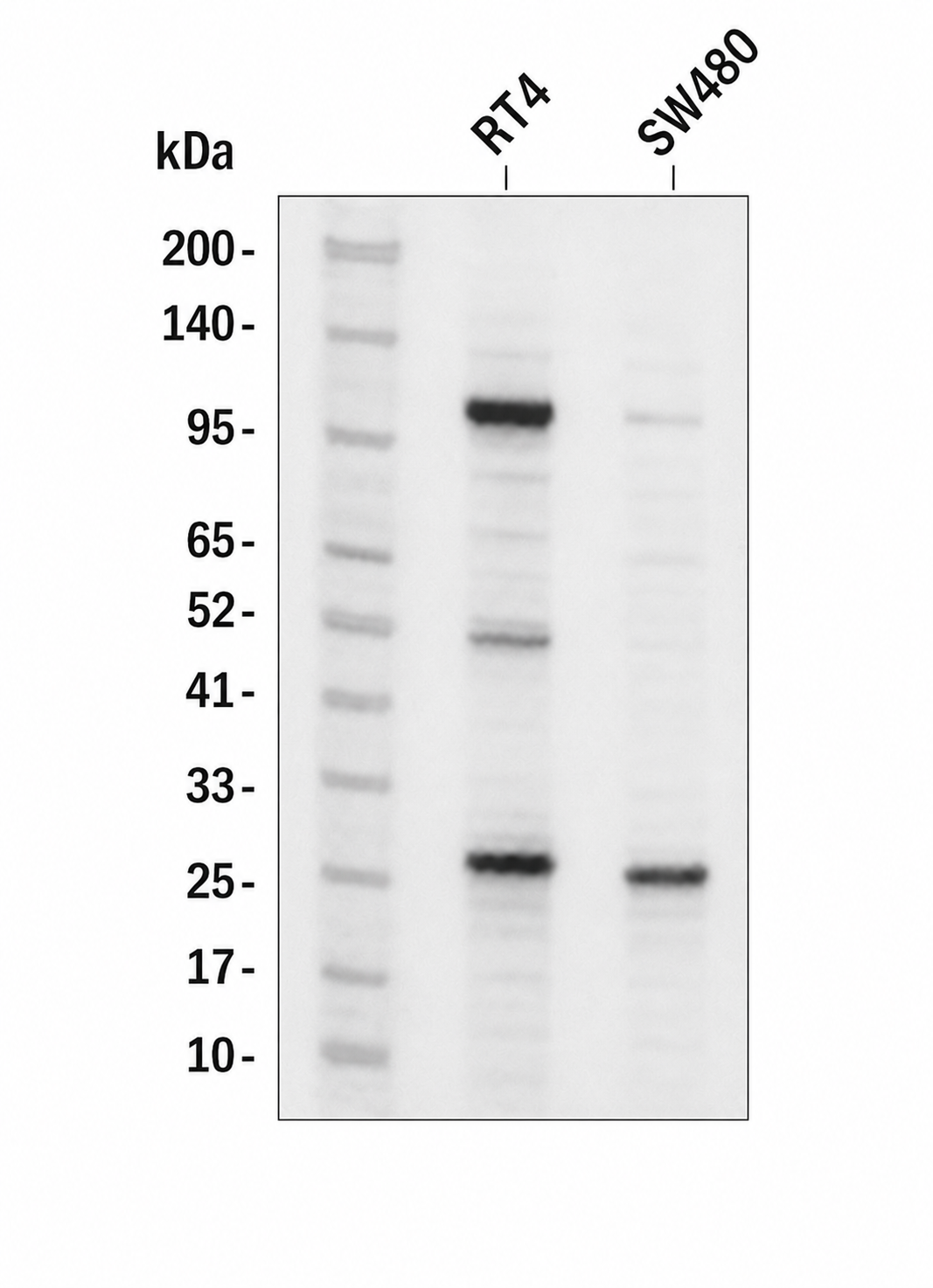 Hes1 (YD13967) Rabbit mAb