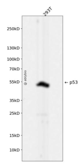 p53 (YD11555) Rabbit mAb