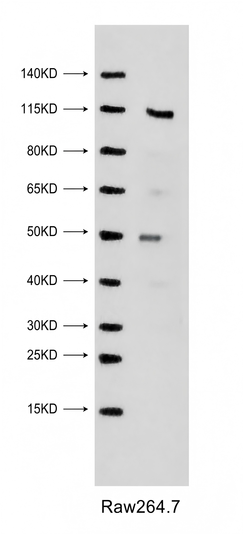 PYK2 (Phospho-Tyr579) Antibody