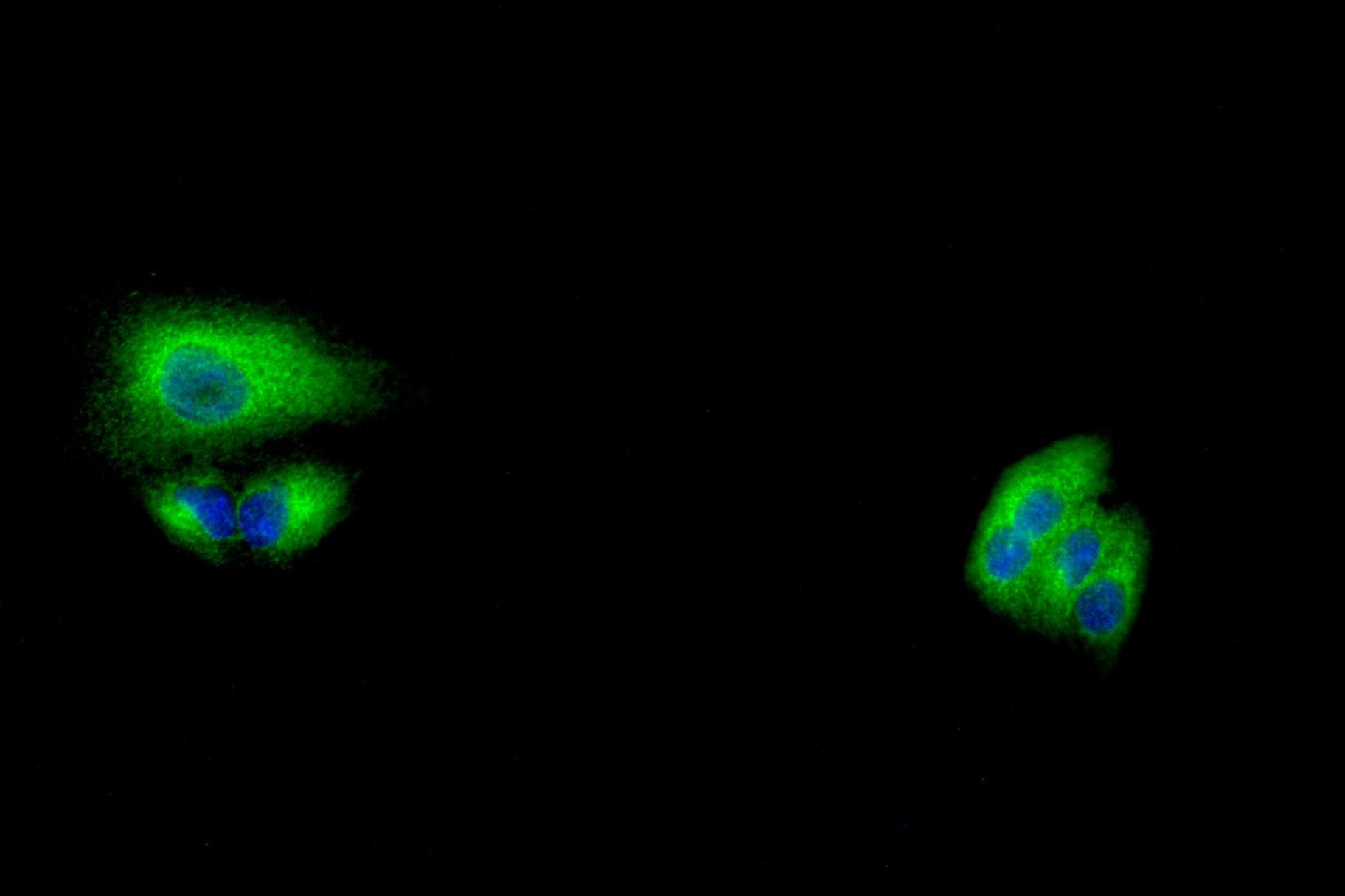 Phospho-beta Catenin (Ser33/Ser37/Thr41) pAb