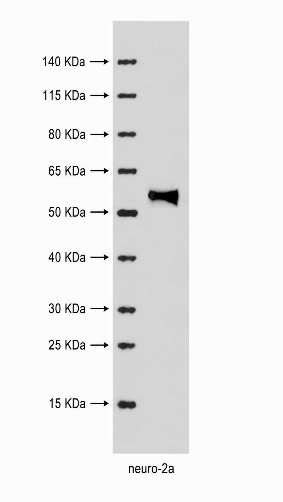 HDAC1 Rabbit mAb