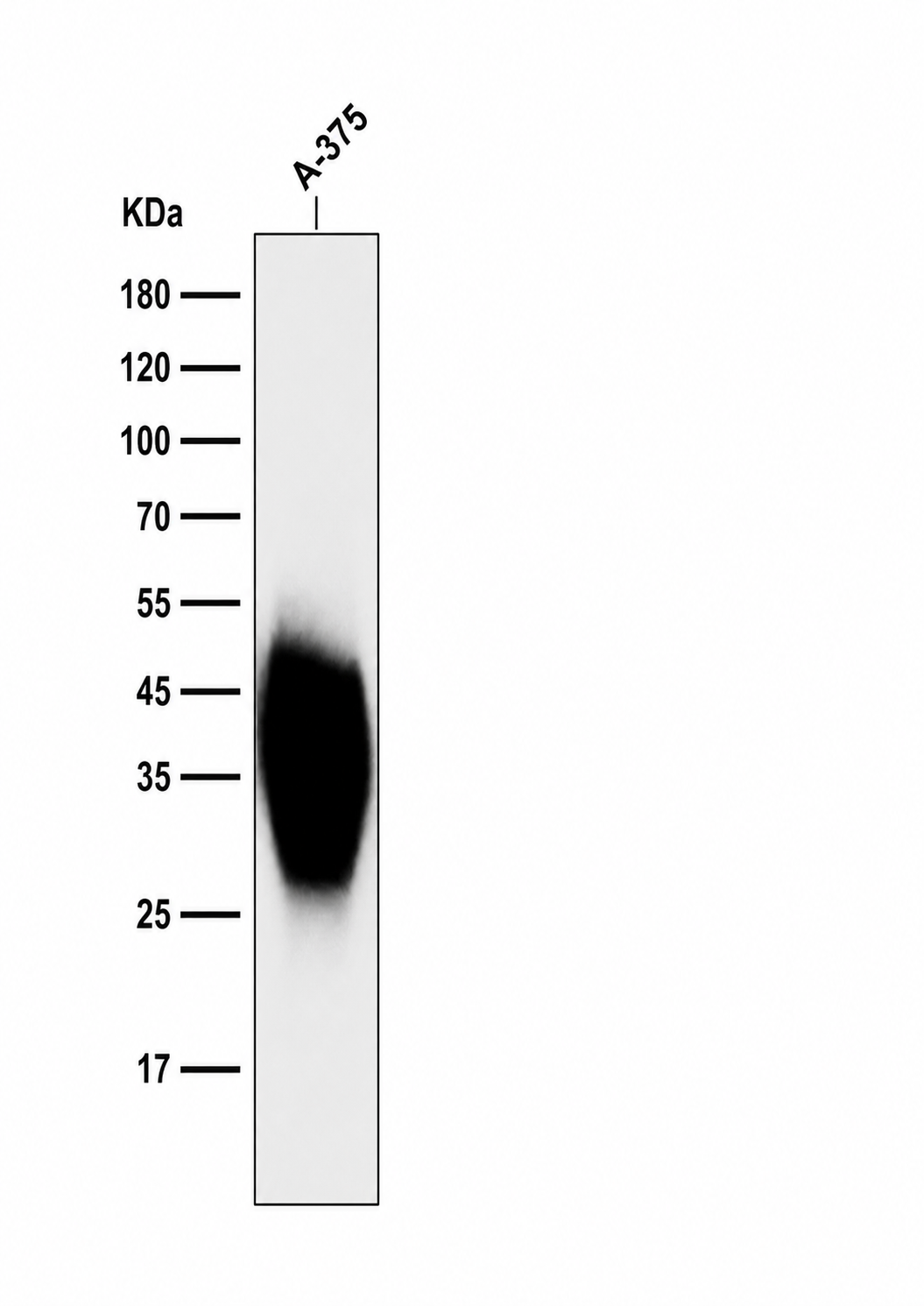 CD63 (YD34905) Mouse mAb