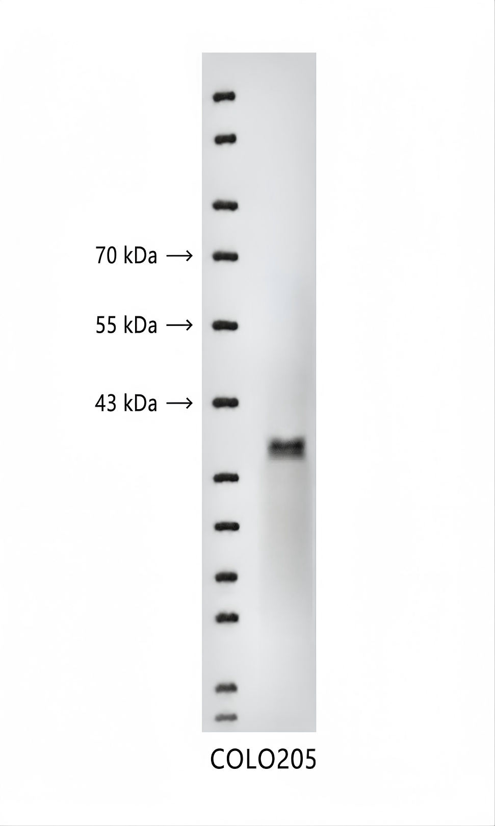 I&kappa;B-&alpha; Rabbit mAb