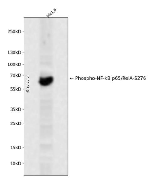 NF-&kappa;B p65 (Phospho-Ser276) Antibody