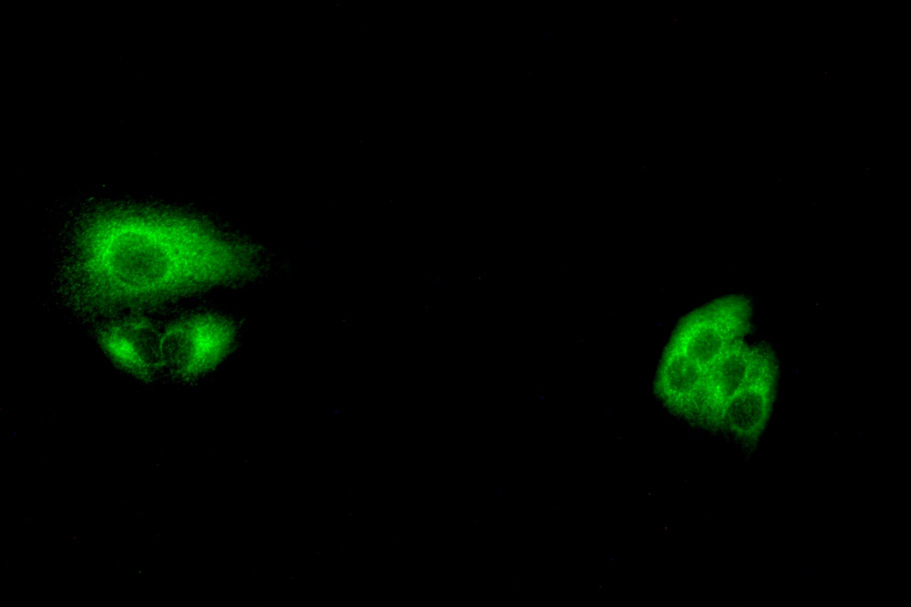 Phospho-beta Catenin (Thr41/Ser45) pAb