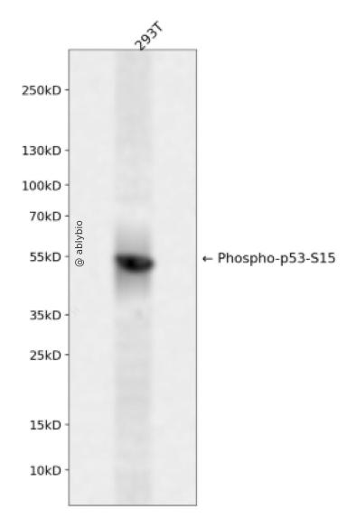 Phospho-p53 (Ser15) pAb