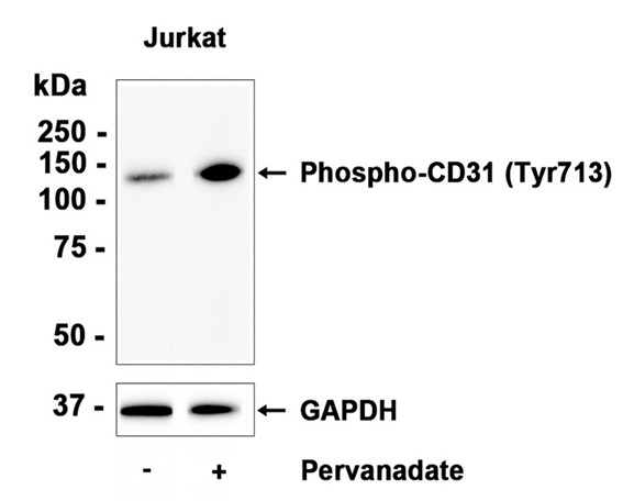AYD13914