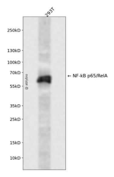 NF-kB p65 (YD36202) Rabbit mAb