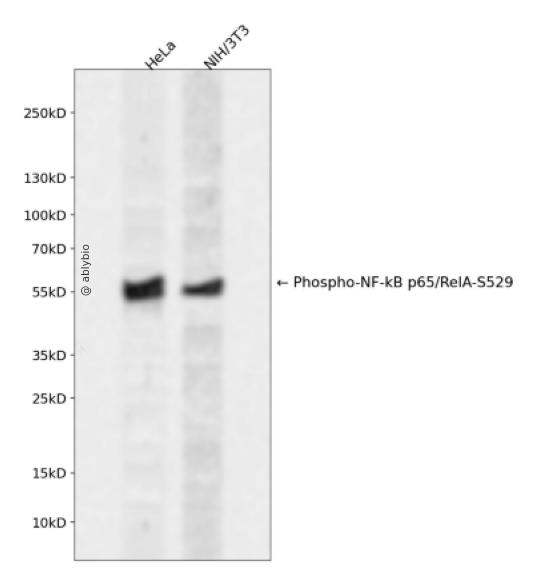 NF-&kappa;B p65 (Phospho-Ser529) Antibody